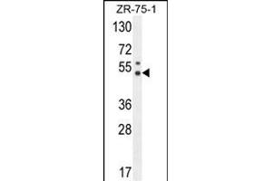 PUS3 Antibody (N-term) (ABIN654789 and ABIN2844467) western blot analysis in ZR-75-1 cell line lysates (35 μg/lane). (PUS3 antibody  (N-Term))