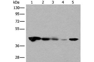 Western blot analysis of Jurkat HEPG2 and Hela cell Human testis tissue 231 cell lysates using CECR5 Polyclonal Antibody at dilution of 1:650 (CECR5 antibody)