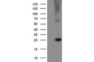 HEK293T cells were transfected with the pCMV6-ENTRY control (Left lane) or pCMV6-ENTRY RABL2A (Right lane) cDNA for 48 hrs and lysed. (RABL2A antibody)