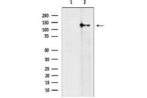 Western blot analysis of lysates from Mouse brain, using RASGRF2 Antibody.