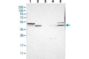 Western blot analysis of Lane 1: RT-4, Lane 2: U-251 MG, Lane 3: Human Plasma, Lane 4: Liver, Lane 5: Tonsil with SOX7 polyclonal antibody .