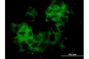 Immunofluorescence of monoclonal antibody to KRTHA3B on MCF-7 cell. (Keratin 33B antibody  (AA 1-404))