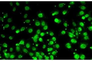 Immunofluorescence analysis of MCF7 cells using QKI Polyclonal Antibody (QKI antibody)