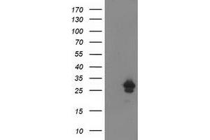 HEK293T cells were transfected with the pCMV6-ENTRY control (Left lane) or pCMV6-ENTRY AK4 (Right lane) cDNA for 48 hrs and lysed. (AK4 antibody)