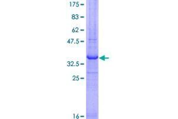 RNF121 Protein (AA 193-301) (GST tag)