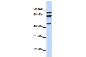 PPP4R2 antibody used at 1 ug/ml to detect target protein. (PPP4R2 antibody  (C-Term))
