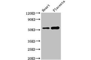 Western Blot Positive WB detected in: Mouse heart tissue, Human placenta tissue All lanes: DOK3 antibody at 3 μg/mL Secondary Goat polyclonal to rabbit IgG at 1/50000 dilution Predicted band size: 54, 24, 36, 25 kDa Observed band size: 54 kDa (DOK3 antibody  (AA 1-146))