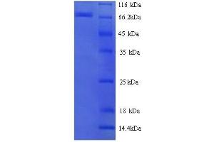 Estrogen Receptor alpha Protein (AA 10-595) (His tag)