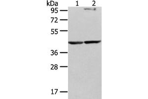 Western Blotting (WB) image for anti-WW Domain Containing Oxidoreductase (WWOX) antibody (ABIN5962023) (WWOX antibody)