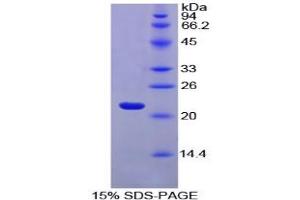 SDS-PAGE analysis of Horse FTL Protein. (Ferritin, Light Polypeptide (FTL) Peptide)