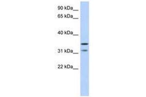 Image no. 1 for anti-Retinoic Acid Induced 12 (RAI12) (AA 143-192) antibody (ABIN6741255) (Retinoic Acid Induced 12 (RAI12) (AA 143-192) antibody)