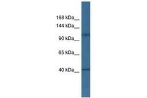 Image no. 1 for anti-Hexokinase 1 (HK1) (AA 313-362) antibody (ABIN6746932) (Hexokinase 1 antibody  (AA 313-362))