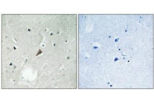 Immunohistochemical analysis of paraffin-embedded human brain tissue using PYK2 (Phospho-Tyr579) antibody (left)or the same antibody preincubated with blocking peptide (right). (PTK2B antibody  (pTyr579))