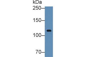 Western Blot; Sample: Human Serum; Primary Ab: 5µg/ml Rabbit Anti-Human ITIH3 Antibody Second Ab: 0. (ITIH3 antibody  (AA 279-467))
