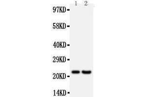 Anti-FGF9 antibody, Western blotting All lanes: Anti FGF9  at 0. (FGF9 antibody  (Middle Region))