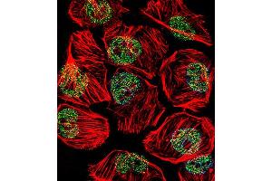 Fluorescent confocal image of  cell stained with TBP Antibody (Center) (ABIN390631 and ABIN2840935). (TBP antibody  (AA 210-239))