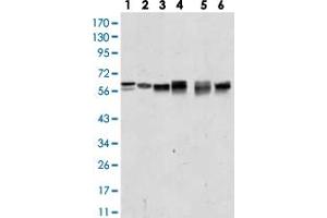 Western Blot (Cell lysate) analysis of (1) A431 , (2) Jurkat, (3) HEK293, (4) A549, (5) MCF-7 and (6) PC-12 cell lysate. (AKT2 antibody)