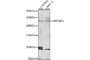 Western blot analysis of extracts of various cell lines, using  antibody (ABIN7265487) at 1:1000 dilution. (ARFGEF1 antibody  (AA 220-420))