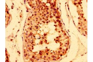 IHC image of ABIN7171496 diluted at 1:400 and staining in paraffin-embedded human testis tissue performed on a Leica BondTM system. (TNKS antibody  (AA 35-130))