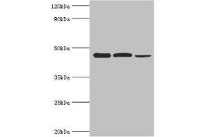 Western blot All lanes: Eukaryotic initiation factor 4A-I antibody at 3 μg/mL Lane 1: K562 whole cell lysate Lane 2: Hela whole cell lysate Lane 3: Rat brain tissue Secondary Goat polyclonal to rabbit IgG at 1/10000 dilution Predicted band size: 47, 40 kDa Observed band size: 47 kDa