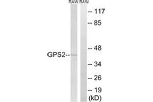 Western blot analysis of extracts from RAW264. (GPS2 antibody  (AA 11-60))