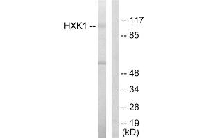 Western blot analysis of extracts from HeLa cells, using HXK1 antibody. (Hexokinase 1 antibody  (N-Term))