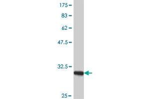 Mitochondrially Encoded NADH Dehydrogenase 4 (MT-ND4) (AA 406-459) antibody