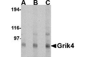 Western Blotting (WB) image for anti-Glutamate Receptor, Ionotropic, Kainate 4 (GRIK4) (N-Term) antibody (ABIN1031397) (GRIK4 antibody  (N-Term))