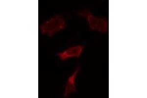 ABIN6274051 staining HepG2 by IF/ICC. (TLR9 antibody  (Internal Region))
