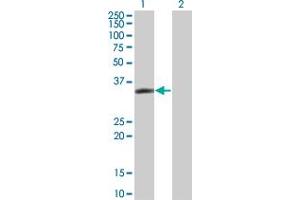 Western Blot analysis of LASP1 expression in transfected 293T cell line by LASP1 monoclonal antibody (M05), clone 4F5. (LASP1 antibody  (AA 1-261))