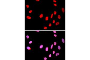 Immunofluorescence analysis of U2OS cells using CDC25C antibody (ABIN6130091, ABIN6138255, ABIN6138256 and ABIN6215163). (CDC25C antibody  (AA 174-473))