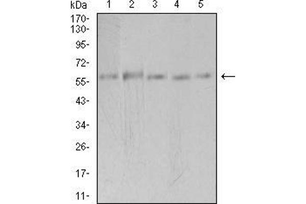 PAK3 antibody  (AA 1-100)