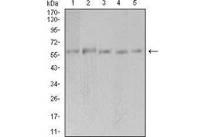 Western blot analysis using PAK3 mouse mAb against Hela (1), SK-N-SH (2), T47D (3), COS7 (4), and HepG2 (5) cell lysate.