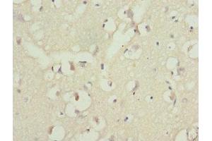 Immunohistochemistry (IHC) image for anti-Protein Phosphatase 2, Regulatory Subunit A, beta (PPP2R1B) (AA 402-601), (Regulatory Subunit A) antibody (ABIN7169260)