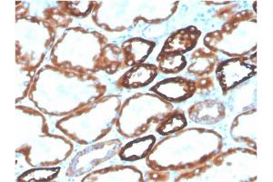 Formalin-fixed, paraffin-embedded human kidney stained with Biotin-conjugated CDH16Mouse Monoclonal Antibody (CDH16/2125). (Cadherin-16 antibody  (AA 371-507) (Biotin))
