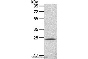 Western blot analysis of 293T cell , using CLEC4D Polyclonal Antibody at dilution of 1:123 (CLEC4D antibody)