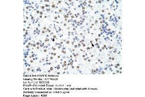 Rabbit Anti-HNRPD Antibody  Paraffin Embedded Tissue: Human Liver Cellular Data: Hepatocytes Antibody Concentration: 4.