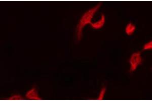 ABIN6267687 staining Hela by IF/ICC. (DOK1 antibody  (pTyr362))