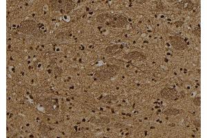 ABIN6265487 and ABIN6278641 at 1/100 staining Rat brain tissue by IHC-P. (T-Box 15/18 antibody  (Internal Region))