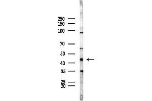 anti-LIM Homeobox 1 (LHX1) (Internal Region) antibody