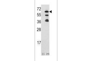 Western blot analysis of ACK1 (arrow) using rabbit polyclonal ACK1 Antibody (Center) (ABIN392084 and ABIN2841843). (TNK2 antibody  (AA 383-411))