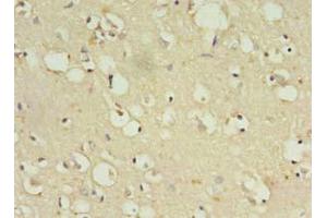 Immunohistochemistry of paraffin-embedded human brain tissue using ABIN7176501 at dilution of 1:100 (ZNF699 antibody  (AA 19-195))