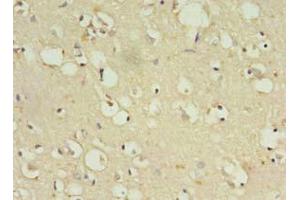 Immunohistochemistry of paraffin-embedded human brain tissue using ABIN7176501 at dilution of 1:100 (ZNF699 antibody  (AA 19-195))