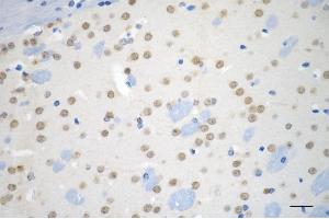 Immunohistochemistry was performed on paraffin-embedded mouse brain using ubiquitination factor E4 B antibody (ABIN7800713), 1:200). (Recombinant UBE4B antibody)