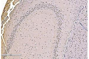 IHC analysis of KHSRP using anti-KHSRP antibody (ABIN7599776).