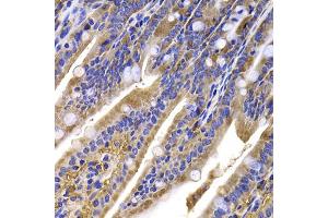 Immunohistochemistry of paraffin-embedded mouse ileum using HDGFRP2 antibody (ABIN5975300) at dilution of 1/100 (40x lens). (HDGFRP2 antibody)