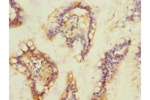 Immunohistochemistry of paraffin-embedded human small intestine tissue using ABIN7170777 at dilution of 1:100 (SOAT2 antibody  (AA 1-120))