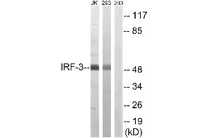 Western blot analysis of extracts from Jurkat cells and 293 cells, using IRF-3 (Ab-386) antibody. (IRF3 antibody  (Ser386))