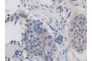 Immunohistochemistry (IHC) image for anti-Iron-Responsive Element Binding Protein 2 (IREB2) (AA 39-281) antibody (ABIN7441505)