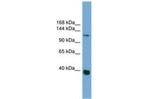 Image no. 1 for anti-Catenin (Cadherin-Associated Protein), delta 1 (CTNND1) (AA 827-876) antibody (ABIN6744923) (CTNND1 antibody  (AA 827-876))